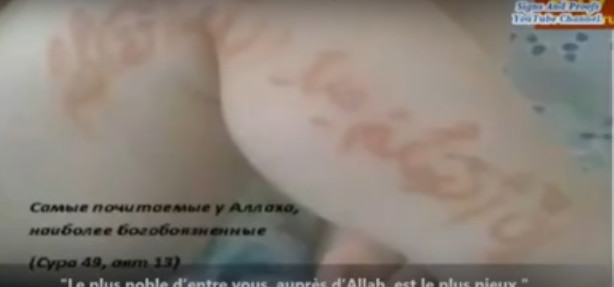 Vidéo : Le bébé russe né avec des versets coraniques sur le corps continue de drainer des foules