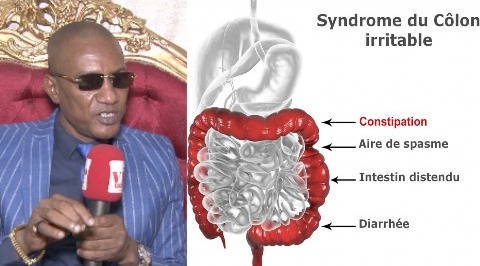 Révélations du Dr Abdoulaye Diallo sur une r@p0rt s&xu&lles et tire sur les hommes...