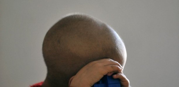 Lutte contre le cancer chez les enfants : Dr Babacar Guèye prône un diagnostic précoce