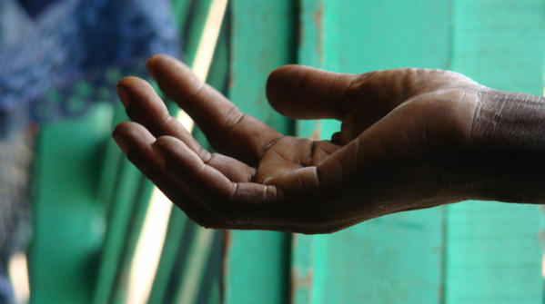 Rafle des mendiants à Mbacké – Les non-voyants en colère dénoncent leur arrestation