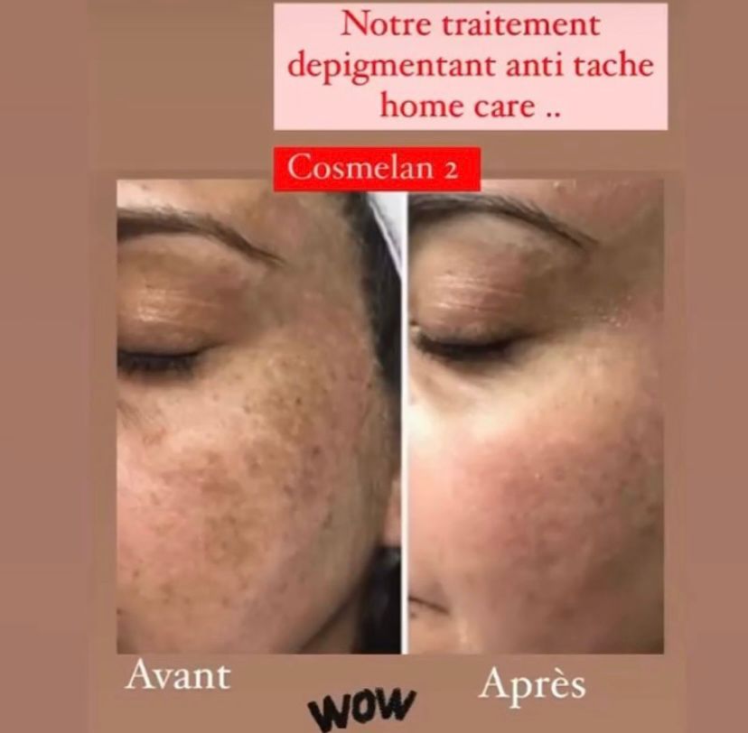 Urgent: OMNYSENS BEAUTE SANTE: découvrez l' expertise et la qualité de vos soins de visages et de la peau