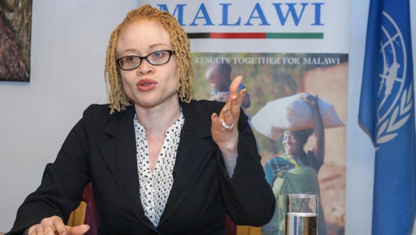 Au Malawi, les albinos menacés d’extermination par la sorcellerie - L'Onu s'en inquiète