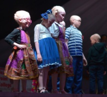 Un concours de beauté pour albinos pour lutter contre les préjugés