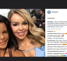 Photos-La leçon de courage de Katie Piper, une jeune femme défigurée à l'acide par son ex