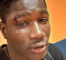 Italie : Agression raciste à Palerme, un Sénégalais battu et blessé