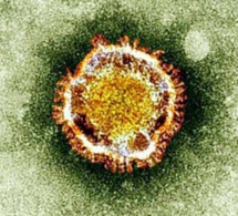 Covid-19: que sait-on de la variante plus "transmissible" du virus en Afrique du Sud?