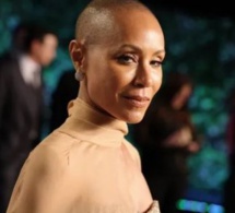 Jada Pinkett Smith souffre d'alopécie, une maladie qui lui fait perdre ses cheveux