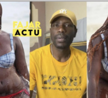 Agression sexuelle présumée : Kaliphone, la mannequin Adji Thiaré Diaw et les « coups et morsures »